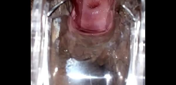  SLIM INDIAN BROWN GIRL CERVIX SPECULUM CHECK VAGINAL OPENING